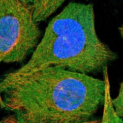 N4BP2 Antibody, Novus Biologicals:Antibodies:Primary Antibodies
